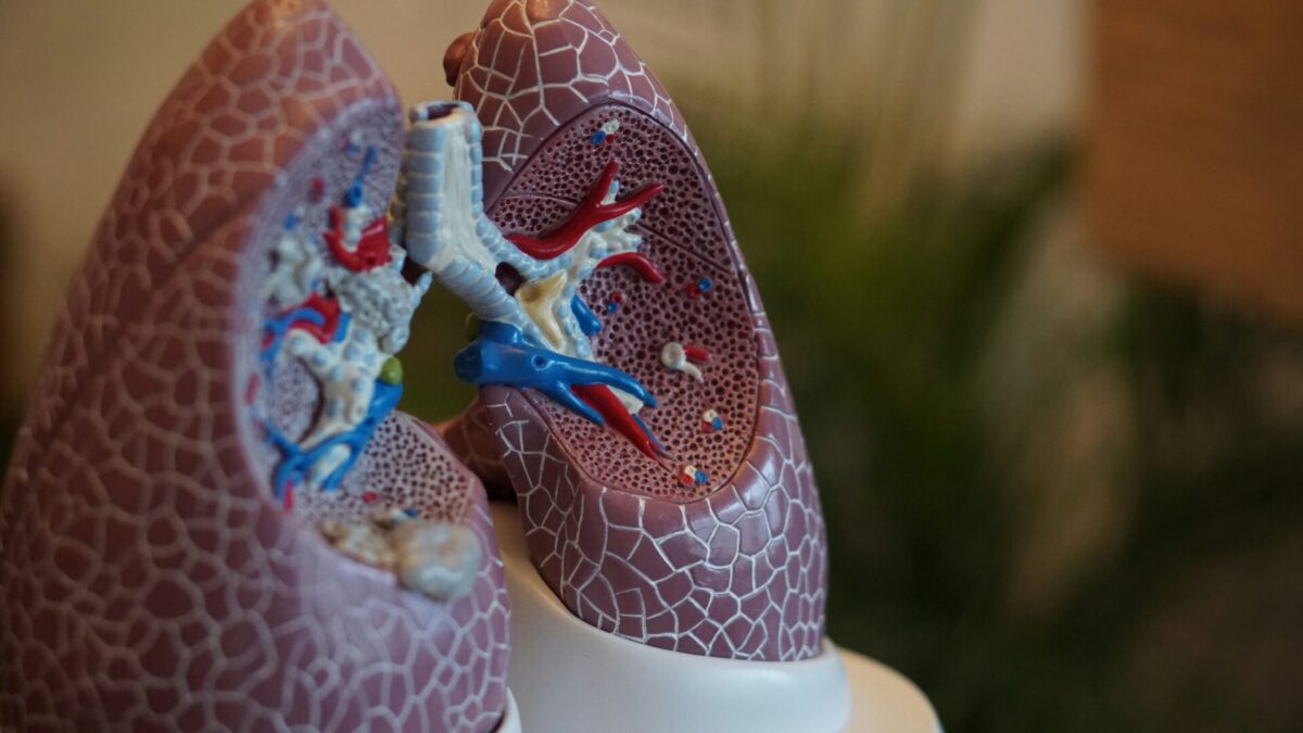 Merck ADC shows 50% tumor shrinkage in lung cancer trial