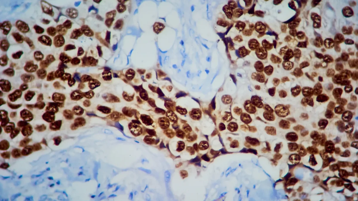 Roche Awaits FDA Decision on Giredestrant for Breast Cancer